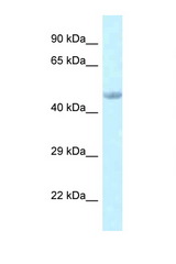 EED antibody LS-C145799 Western blot of Rat Muscle lysate. Antibody concentration 1 ug/ml.