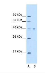 Lane A: Marker. Lane B: HepG2 cell lysate. Antibody concentration: 2.5 ug/ml. Gel concentration: 12%.