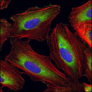 Confocal immunofluorescence of HeLa cells using LS-C65201(green).