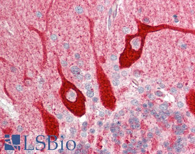 Human Brain, Cerebellum: Formalin-Fixed, Paraffin-Embedded (FFPE)