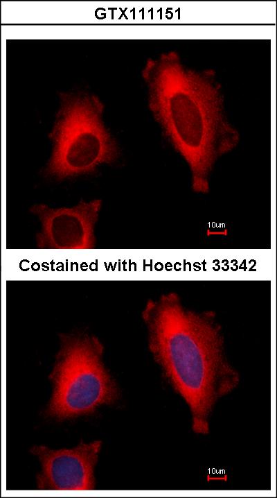 Immunofluorescence of methanol-fixed HeLa, using EEF1D antibody at 1:500 dilution.