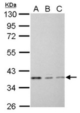 EEF1D antibody detects EEF1D protein by Western blot analysis.A. 30 ug THP-1 whole cell lysate/extract B. 30 ug HL-60 whole cell lysate/extract C. 30 ug NCI-H929 whole cell lysate/extract10 % SDS-PAGEEEF1D antibody dilution: 1:1000