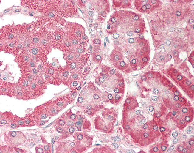 Human Pancreas: Formalin-Fixed, Paraffin-Embedded (FFPE)