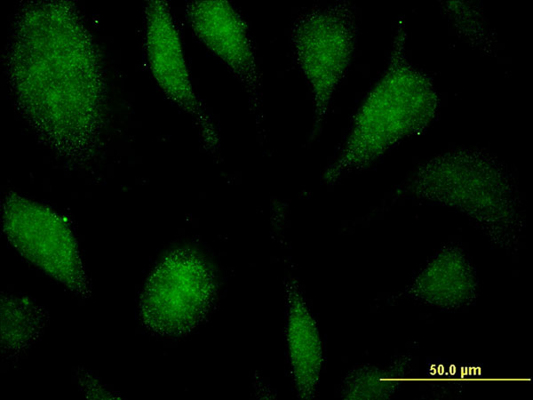 Immunofluorescence of monoclonal antibody to EEF1D on HeLa cell . [antibody concentration 10 ug/ml]