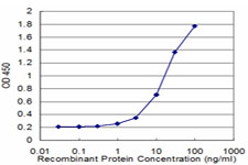 Detection limit for recombinant GST tagged EEF1D is approximately 1 ng/ml as a capture antibody.