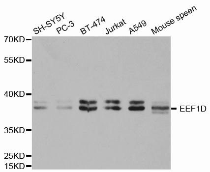 Western blot analysis of extracts of various cell lines, using EEF1D antibody.