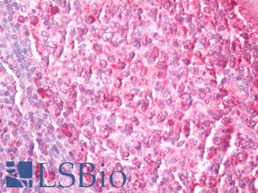 Human Tonsil: Formalin-Fixed, Paraffin-Embedded (FFPE) 