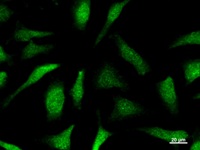 Immunostaining analysis in HeLa cells. HeLa cells were fixed with 4% paraformaldehyde and permeabilized with 0.1% Triton X-100 in PBS. The cells were immunostained with anti-CLNS1A mAb.