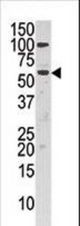 Western blot of anti-CHK in HepG2 cell line lysate (35 ug/lane). CHK(arrow) was detected using the purified antibody.