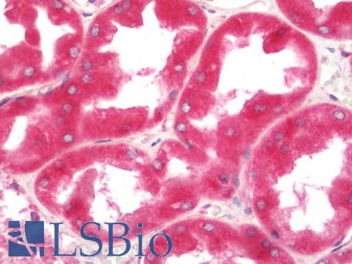 Human Kidney: Formalin-Fixed, Paraffin-Embedded (FFPE)