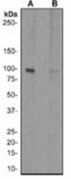 Western blot analysis on 293 cell lysates using anti-Phospho-eEF2 (pT56/58) antibody (LS-C105242), 1:2000 dilution. Cells were either (A) untreated (B) starved.