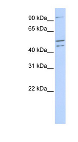 CLOCK antibody LS-C109824 Western blot of 721_B cell lysate.