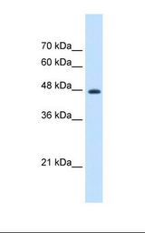 HepG2 cell lysate. Antibody concentration: 1.25 ug/ml. Gel concentration: 12%.