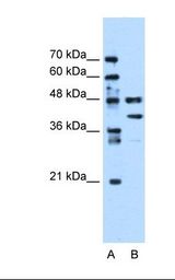 Lane A: Marker. Lane B: Jurkat cell lysate. Antibody concentration: 0.25 ug/ml. Gel concentration: 12%.