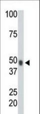 The anti-CHK antibody is used in Western blot to detect CHK in mouse heart tissue lysate.