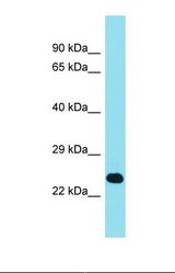 Western blot of Human RPMI-8226. EFCAB1 antibody dilution 1.0 ug/ml.