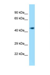 4732418C07Rik antibody LS-C146389 Western blot of Mouse Liver lysate. Antibody concentration 1 ug/ml.