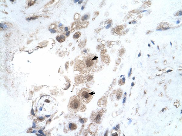 KIAA0494 antibody LS-C80988 was used in IHC to stain formalin-fixed, paraffin-embedded human placenta.