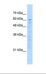 HepG2 cell lysate. Antibody concentration: 5.0 ug/ml. Gel concentration: 12%.
