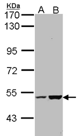 Sample (30 ug of whole cell lysate). A: Molt-4 , B: Raji. 7.5% SDS PAGE. KIAA0494 antibody diluted at 1:1000.