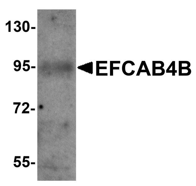 Western blot analysis of EFCAB4B in mouse kidney tissue lysate with EFCAB4B antibody at 1 ug/ml.