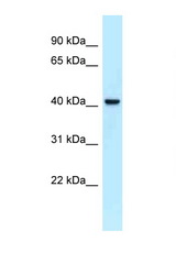 NECAB2 antibody LS-C145902 Western blot of Fetal Heart lysate. Antibody concentration 1 ug/ml.