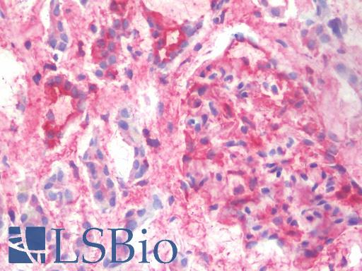 IHC with EFHD1 antibody on frozen human kidney.