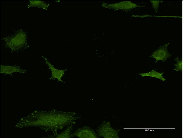 Immunofluorescence of monoclonal antibody to EFHD1 on HeLa cell [antibody concentration 10 ug/ml].