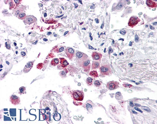 Anti-EFHD1 antibody IHC of human lung. Immunohistochemistry of formalin-fixed, paraffin-embedded tissue after heat-induced antigen retrieval. Antibody LS-B4638 concentration 5 ug/ml.