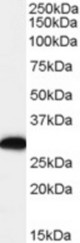 Antibody (0.1 ug/ml) staining of human lymph node lysate. Primary incubation was 1 hour. Detected by chemiluminescence.