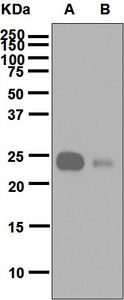 Western blot analysis on (A) HUVEC cell treated with TNF alpha and (B) HUVEC cell lysates using anti-Ephrin-A1 antibody.