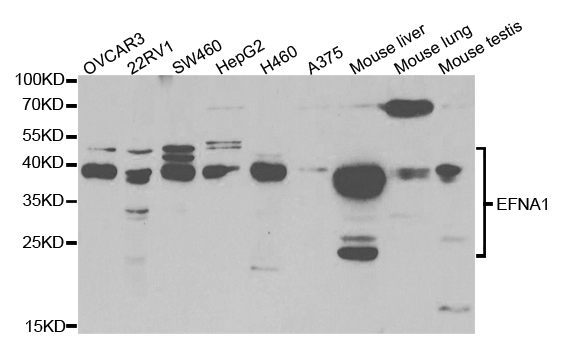 Western blot analysis of extracts of various cell lines, using EFNA1 antibody.