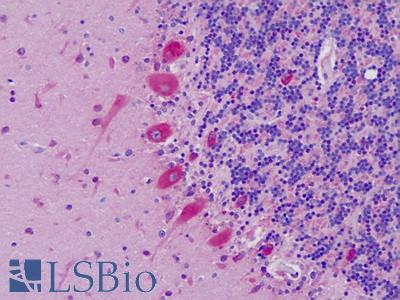Human, Brain, Cerebellum: Formalin-Fixed Paraffin-Embedded (FFPE)