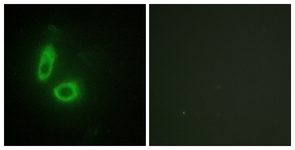 Immunofluorescence of HeLa cells, using EFNA1 Antibody. The picture on the right is treated with the synthesized peptide.