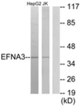 Western blot of extracts from HepG2/Jurkat cells, using EFNA3 Antibody. The lane on the right is treated with the synthesized peptide.