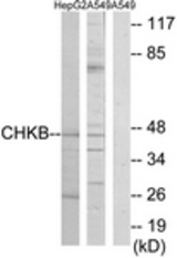 Western blot of extracts from HepG2/A549 cells, using CHKB Antibody. The lane on the right is treated with the synthesized peptide.