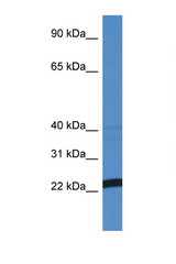 EFNA4 / Ephrin A4 antibody LS-C145408 Western blot of MCF7 Cell lysate. Antibody concentration 1 ug/ml.