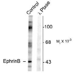 Western blot of rat testes lysate showing specific immunolabeling of the ~46k EphrinB phosphorylated at Tyr317 (Control). The phosphospecificity of this labeling is shown in the second lane (lambda-phosphatase: lambda-Ptase). The blot is identical to the
