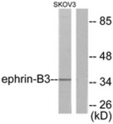 Western blot of extracts from SKOV3 cells, using EFNB3 Antibody. The lane on the right is treated with the synthesized peptide.