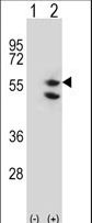 Western blot of TUFM (arrow) using rabbit polyclonal TUFM Antibody. 293 cell lysates (2 ug/lane) either nontransfected (Lane 1) or transiently transfected (Lane 2) with the TUFM gene.