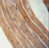 EFTUD1 antibody immunohistochemistry of formalin-fixed and paraffin-embedded human skeletal muscle followed by peroxidase-conjugated secondary antibody and DAB staining.
