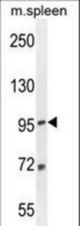 EFTUD1 Antibody western blot of mouse spleen tissue lysates (35 ug/lane). The EFTUD1 antibody detected the EFTUD1 protein (arrow).