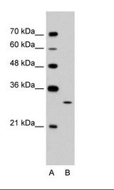 A: Marker, B: Jurkat Cell Lysate