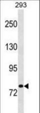 CHM Antibody western blot of 293 cell line lysates (35 ug/lane). The CHM antibody detected the CHM protein (arrow).