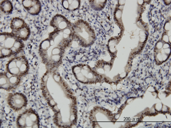 Immunoperoxidase of monoclonal antibody to CHFR on formalin-fixed paraffin-embedded human small Intestine. [antibody concentration 2 ug/ml]