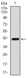 Western blot using COTL1 monoclonal antibody against human COTL1 (AA: 1-142) recombinant protein. (Expected MW is 16 kDa)