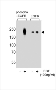 Western blot of lysate from A431 cells(from left to right),untreated or treated with EGF at 100ng/ml,using Phospho-EGFR-pY1016 Antibody or EGFR-pS695 Antibody.Lysate at 15ug per lane.Antibody was diluted at 1:8000 dilution at each lane. A goat anti-rabbit IgG H&L (HRP) at 1:5000 dilution was used as the secondary antibody.