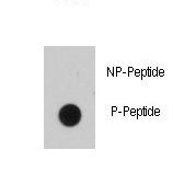 Dot blot of anti-EGFR B1 Phospho-specific antibody on nitrocellulose membrane. 50ng of Phospho-peptide or Non Phospho-peptide per dot were adsorbed. Antibody working concentrations are 0.5ug per ml.