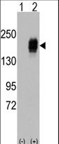 Western blot of EGFR (arrow) using rabbit polyclonal EGFR Antibody. 293 cell lysates (2 ug/lane) either nontransfected (Lane 1) or transiently transfected with the EGFR gene (Lane 2) (Origene Technologies).
