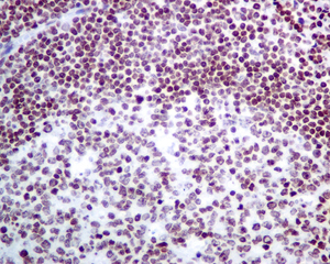 IHC of paraffin-embedded human tonsil tissue using anti-CLP1 antibody.